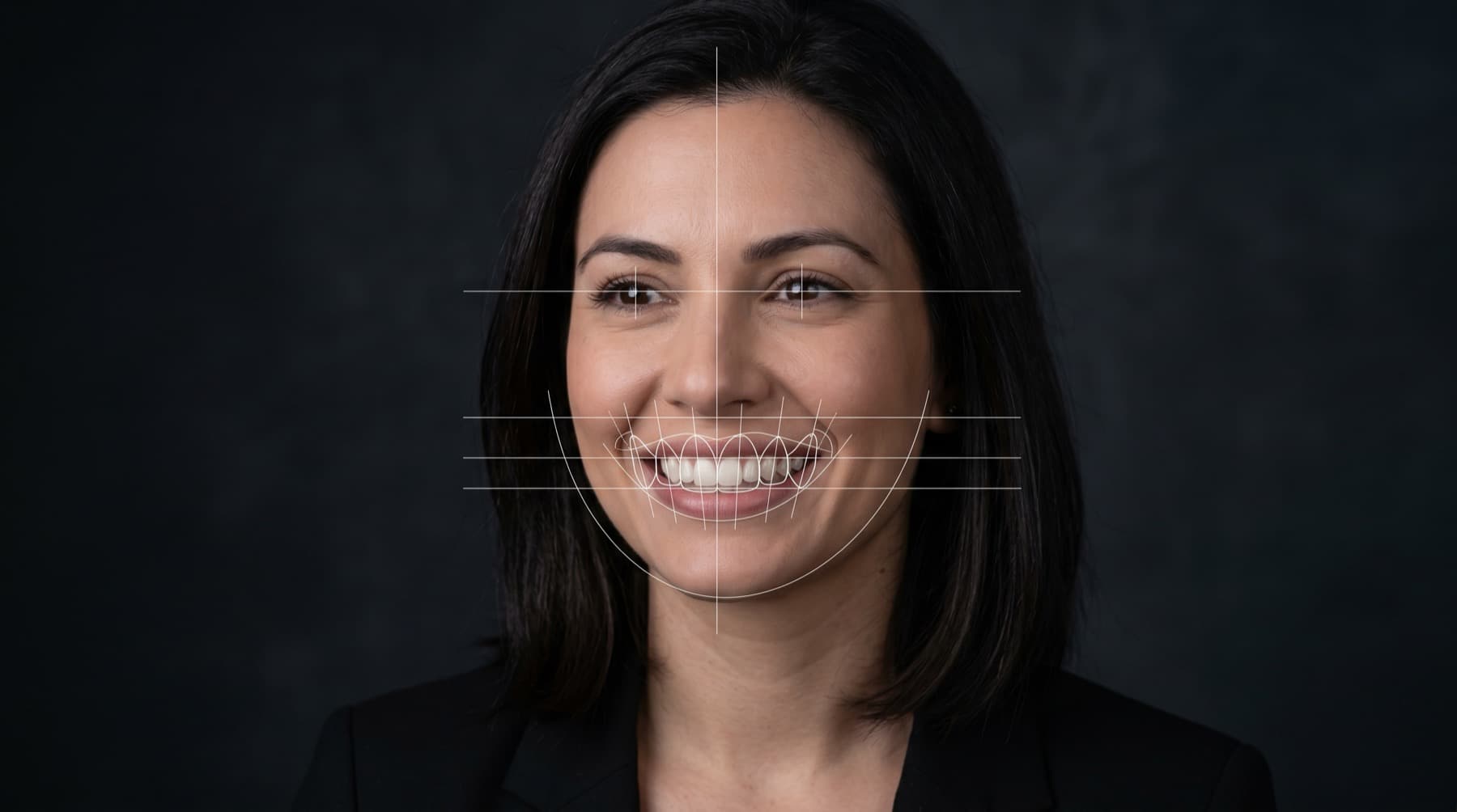 Análisis facial digital para diseño de sonrisa con líneas guía